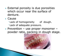 🞂​ External porosity is due porosities
which occur near the surface of
denture.
🞂​ Cause
◦Lack of homogeneity of dough.
◦Lack of adequate pressure.
🞂​ Prevention – use proper monomer –
powder ratio, packing in dough stage.
 
