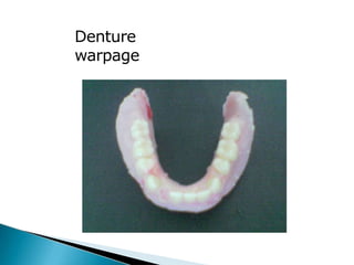 Denture
warpage
 