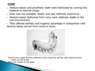 IVORY
🞂​ Denture bases and prosthetic teeth were fashioned by carving this
material to desired shape
🞂​ Ivory was not available readily and was relatively expensive.
🞂​ Denture bases fashioned from ivory were relatively stable in the
oral environment
🞂​ They offered esthetic and hygienic advantage in comparison with
denture bases carved from wood or bone.
Carved ivory upper denture retained in the mouth by springs with natural human
teeth cut off at the
Neck and riveted at the base.
 