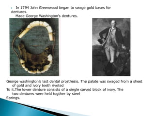 🞂​ In 1794 John Greenwood began to swage gold bases for
dentures.
Made George Washington's dentures.
George washington’s last dental prosthesis. The palate was swaged from a sheet
of gold and ivory teeth riveted
To it.The lower denture consists of a single carved block of ivory. The
two dentures were held togther by steel
Springs.
 