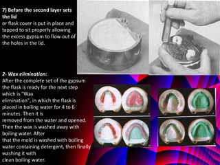7) Before the second layer sets
the lid
or flask cover is put in place and
tapped to sit properly allowing
the excess gypsum to flow out of
the holes in the lid.




2- Wax elimination:
After the complete set of the gypsum
the flask is ready for the next step
which is "Wax
elimination", in which the flask is
placed in boiling water for 4 to 6
minutes. Then it is
removed from the water and opened.
Then the wax is washed away with
boiling water. After
that the mold is washed with boiling
water containing detergent, then finally
washing it with
clean boiling water.
 