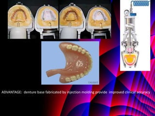 ADVANTAGE: denture base fabricated by injection molding provide improved clinical accuracy
 