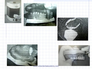 Denture base resins/cosmetic dentistry courses