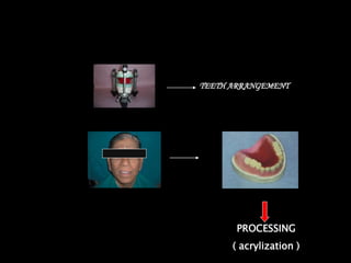 PROCESSING
( acrylization )
TEETH ARRANGEMENT
 