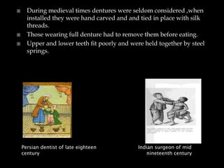  During medieval times dentures were seldom considered ,when
installed they were hand carved and and tied in place with silk
threads.
 Those wearing full denture had to remove them before eating.
 Upper and lower teeth fit poorly and were held together by steel
springs.
Persian dentist of late eighteen
century
Indian surgeon of mid
nineteenth century
 