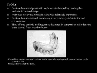 IVORY
 Denture bases and prosthetic teeth were fashioned by carving this
material to desired shape
 Ivory was not available readily and was relatively expensive.
 Denture bases fashioned from ivory were relatively stable in the oral
environment
 They offered esthetic and hygienic advantage in comparison with denture
bases carved from wood or bone.
Carved ivory upper denture retained in the mouth by springs with natural human teeth
cut off at the
Neck and riveted at the base.
 