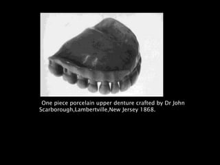 One piece porcelain upper denture crafted by Dr John
Scarborough,Lambertville,New Jersey 1868.
 