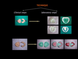 TECHNIQUE
Clinical steps laboratory steps
 