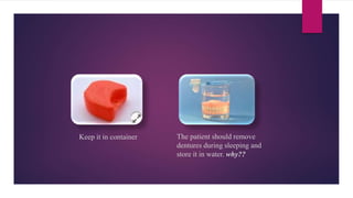 The patient should remove
dentures during sleeping and
store it in water. why??
Keep it in container
 