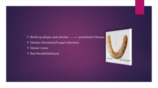  Build-up plaque and calculus periodontal Disease
 Denture Stomatitis(Fungal infection).
 Dental Caries
 Bad Breath(Halitosis)
 
