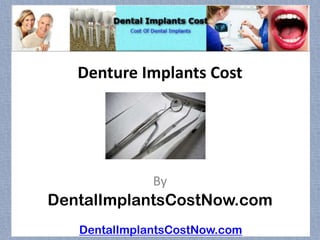 Denture Implants Cost




              By
DentalImplantsCostNow.com
   DentalImplantsCostNow.com
 