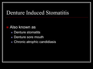 Denture Induced Stomatitis
 Also known as
 Denture stomatits
 Denture sore mouth
 Chronic atrophic candidiasis
 