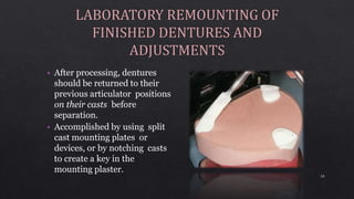 • After processing, dentures
should be returned to their
previous articulator positions
on their casts before
separation.
• Accomplished by using split
cast mounting plates or
devices, or by notching casts
to create a key in the
mounting plaster.
10
 