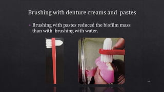 • Brushing with pastes reduced the biofilm mass
than with brushing with water.
105
 