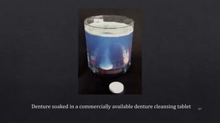 107
Denture soaked in a commercially available denture cleansing tablet
 