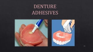 115
DENTURE
ADHESIVES
 