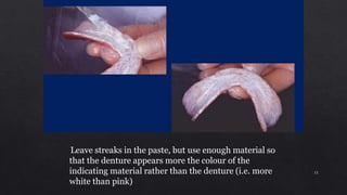 Leave streaks in the paste, but use enough material so
that the denture appears more the colour of the
indicating material rather than the denture (i.e. more
white than pink)
15
 