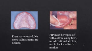 Even paste record. No
more adjustments are
needed.
PIP must be wiped off
with cotton using firm,
uni-directional strokes,
not in back and forth
mation.
19
 