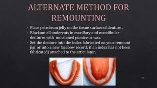 • Place petroleum jelly on the tissue surface of denture .
• Blockout all undercuts in maxillary and mandibular
dentures with moistened pumice or wax.
• Set the denture into the index fabricated on your remount
jig( or into a new facebow record, if an index has not been
fabricated) attached to the articulator.
21
 