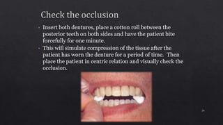 • Insert both dentures, place a cotton roll between the
posterior teeth on both sides and have the patient bite
forcefully for one minute.
• This will simulate compression of the tissue after the
patient has worn the denture for a period of time. Then
place the patient in centric relation and visually check the
occlusion.
29
 