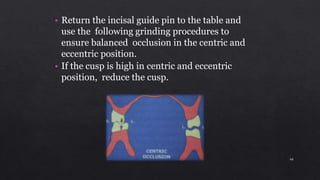 • Return the incisal guide pin to the table and
use the following grinding procedures to
ensure balanced occlusion in the centric and
eccentric position.
• If the cusp is high in centric and eccentric
position, reduce the cusp.
40
 