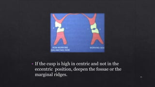• If the cusp is high in centric and not in the
eccentric position, deepen the fossae or the
marginal ridges. 41
 