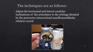 • Adjust the horizontal and lateral condylar
inclinations of the articulator to the settings dictated
by the protrusive interocclusal maxillomandibular
relation record.
55
 
