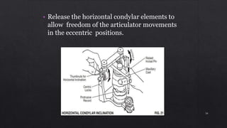 • Release the horizontal condylar elements to
allow freedom of the articulator movements
in the eccentric positions.
56
 