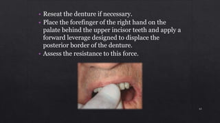 • Reseat the denture if necessary.
• Place the forefinger of the right hand on the
palate behind the upper incisor teeth and apply a
forward leverage designed to displace the
posterior border of the denture.
• Assess the resistance to this force.
63
 