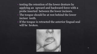 • testing the retention of the lower denture by
applying an upward and backward force with a
probe inserted between the lower incisors.
• The tongue should be at rest behind the lower
incisor teeth.
• If the tongue is retracted the anterior lingual seal
will be broken.
64
 