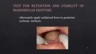 • Alternately apply unilateral force to posterior
occlusal surfaces.
66
 