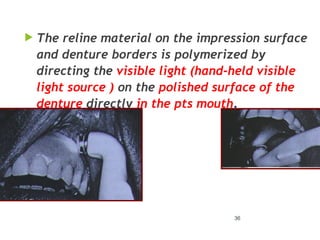36
 The reline material on the impression surface
and denture borders is polymerized by
directing the visible light (hand-held visible
light source ) on the polished surface of the
denture directly in the pts mouth.
 