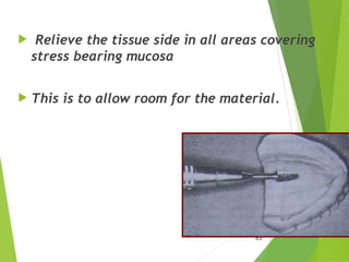 63
 Relieve the tissue side in all areas covering
stress bearing mucosa
 This is to allow room for the material.
 