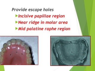 64
Provide escape holes
Incisive papillae region
Near ridge in molar area
Mid palatine raphe region
 