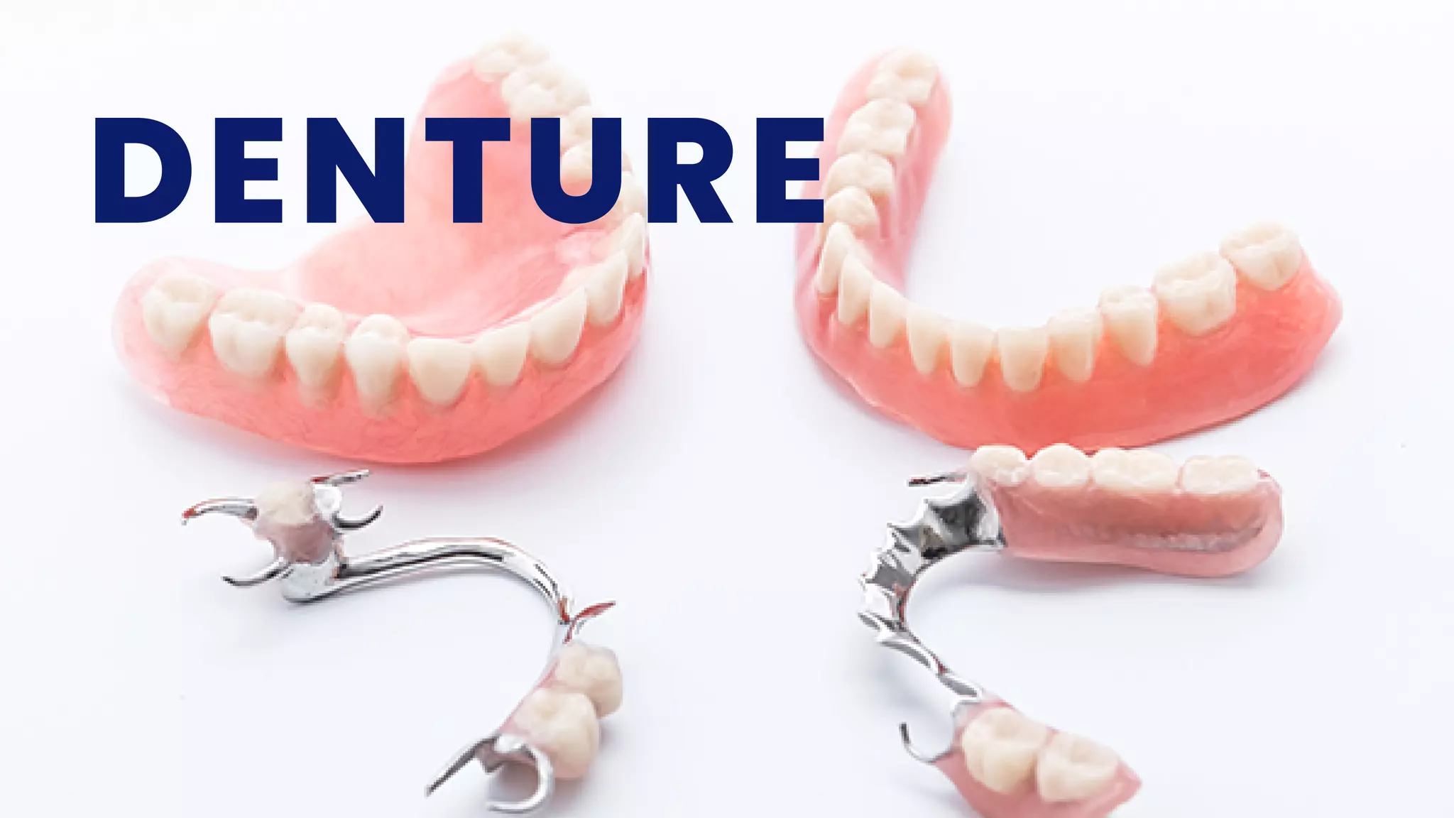DENTURES - CLASSIFICATION OF PARTIALLY EDENTULOUS ARCHES - CLASPS.pdf