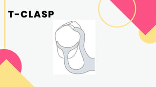 DENTURES - CLASSIFICATION OF PARTIALLY EDENTULOUS ARCHES - CLASPS.pdf
