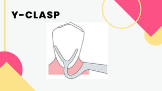 DENTURES - CLASSIFICATION OF PARTIALLY EDENTULOUS ARCHES - CLASPS.pdf