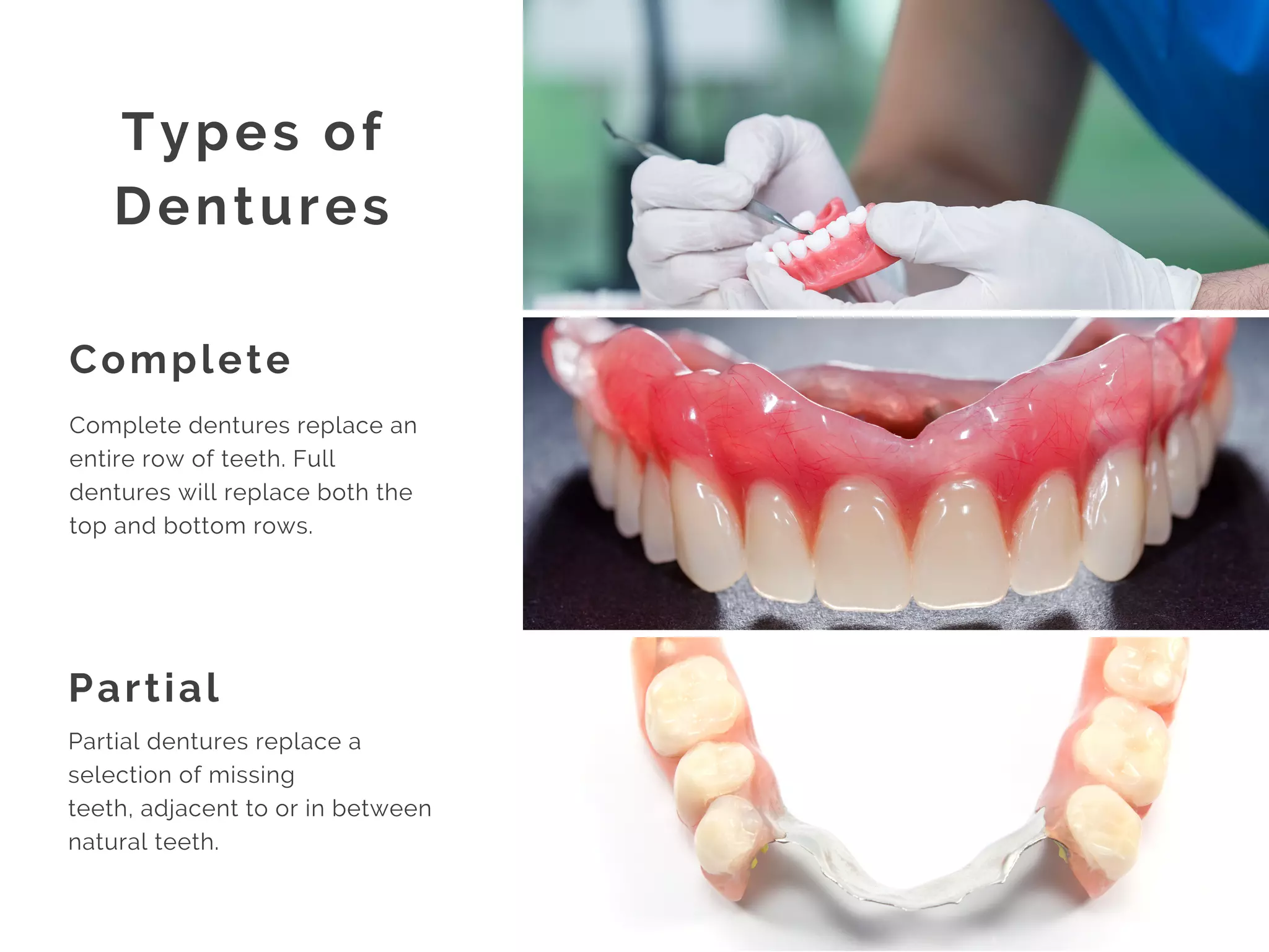 Complete
Partial
Types of
Dentures
Complete dentures replace an
entire row of teeth. Full
dentures will replace both the
top and bottom rows.
Partial dentures replace a
selection of missing
teeth, adjacent to or in between
natural teeth.
 
