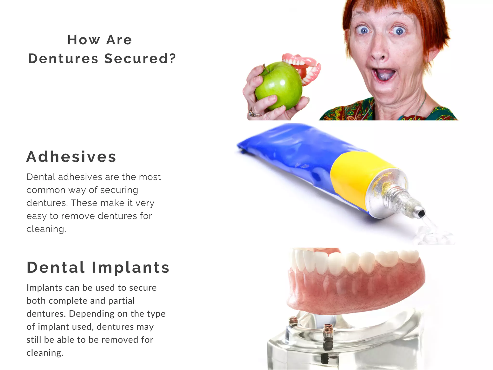 Adhesives
Dental Implants
How Are
Dentures Secured?
Dental adhesives are the most
common way of securing
dentures. These make it very
easy to remove dentures for
cleaning.
Implants can be used to secure
both complete and partial
dentures. Depending on the type
of implant used, dentures may
still be able to be removed for
cleaning.
 
