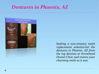 Dentures in Phoenix, AZ
Seeking a non-invasive tooth
replacement solution:Get the
dentures in Phoenix, AZ from
the top dentists at Arrowhead
Dental Clinic and restore your
charming smile as it was.
 
