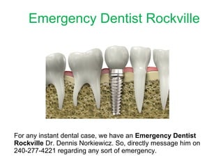 Emergency Dentist Rockville
For any instant dental case, we have an Emergency Dentist
Rockville Dr. Dennis Norkiewicz. So, directly message him on
240-277-4221 regarding any sort of emergency.
 