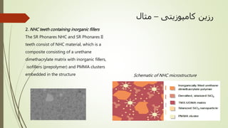 ‫کامپوزیتی‬ ‫رزین‬–‫مثال‬
2. NHC teeth containing inorganic fillers
The SR Phonares NHC and SR Phonares II
teeth consist of NHC material, which is a
composite consisting of a urethane
dimethacrylate matrix with inorganic fillers,
isofillers (prepolymer) and PMMA clusters
embedded in the structure Schematic of NHC microstructure
 