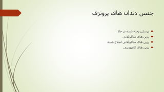 ‫پروتزی‬ ‫های‬ ‫دندان‬ ‫جنس‬
‫خال‬ ‫در‬ ‫شده‬ ‫پخته‬ ‫پرسلن‬
‫متاکریالتی‬ ‫های‬ ‫رزین‬
‫شده‬ ‫اصالح‬ ‫متاکریالتی‬ ‫های‬ ‫رزین‬
‫کامپوزیتی‬ ‫های‬ ‫رزین‬
 