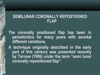 Denuded root coverage | PPT