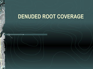 DENUDED ROOT COVERAGE
 
