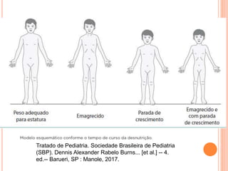 Tratado de Pediatria. Sociedade Brasileira de Pediatria
(SBP). Dennis Alexander Rabelo Burns... [et al.] -- 4.
ed.-- Barueri, SP : Manole, 2017.
 