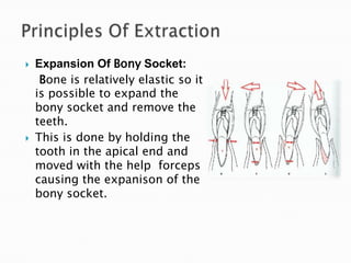  Expansion Of Bony Socket:
Bone is relatively elastic so it
is possible to expand the
bony socket and remove the
teeth.
 This is done by holding the
tooth in the apical end and
moved with the help forceps
causing the expanison of the
bony socket.
 