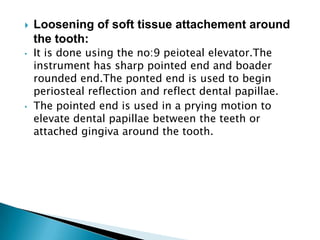  Loosening of soft tissue attachement around
the tooth:
• It is done using the no:9 peioteal elevator.The
instrument has sharp pointed end and boader
rounded end.The ponted end is used to begin
periosteal reflection and reflect dental papillae.
• The pointed end is used in a prying motion to
elevate dental papillae between the teeth or
attached gingiva around the tooth.
 