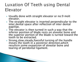 Usually done with straight elevator or no:9 molt
elevator.
 The straight elevator is inserted perpendicular to the
inter dental space after reflection of inter dental
papillae.
 The elevator is then turned in such a way that the
inferior position of blade rests on alveolar bone and
the superior portion of the blade is turned toward the
tooth to be extracted.
 Strong,slow,steady,foeceful turning of the handle
moves the tooth in a posterior direction,which
resultsin some expansion of alveolar bone and
tearing of peridontal ligament.
 