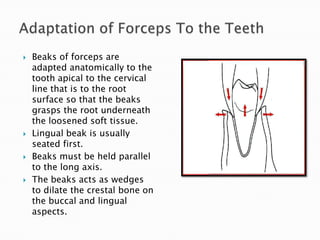 Beaks of forceps are
adapted anatomically to the
tooth apical to the cervical
line that is to the root
surface so that the beaks
grasps the root underneath
the loosened soft tissue.
 Lingual beak is usually
seated first.
 Beaks must be held parallel
to the long axis.
 The beaks acts as wedges
to dilate the crestal bone on
the buccal and lingual
aspects.
 